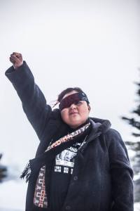 Water protector Vanessa Dundon lost the sight in her right eye after being struck by a tear gas canister. Photo: Adam Alexander