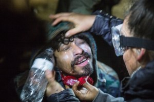 Water protector being treated by a medic after being tear gassed. Photo: Adam Alexander